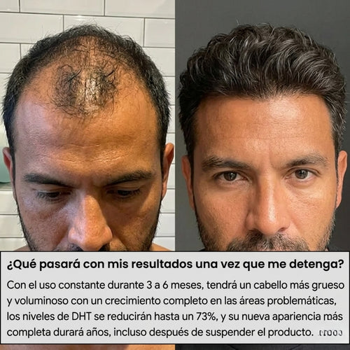 ALFAVITA - Sistema Regeneración Capilar